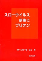 スローウイルス感染とプリオン